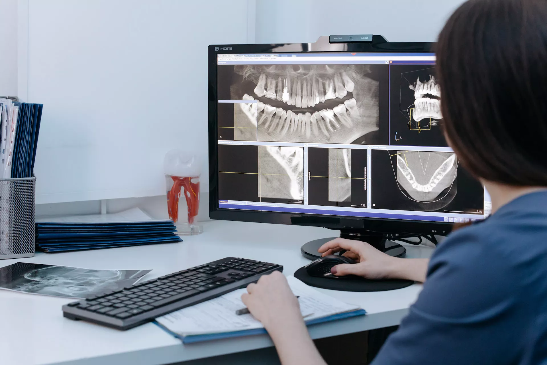 Une dentiste regarde les radiographie panoramique dentaire sur son ordinateur