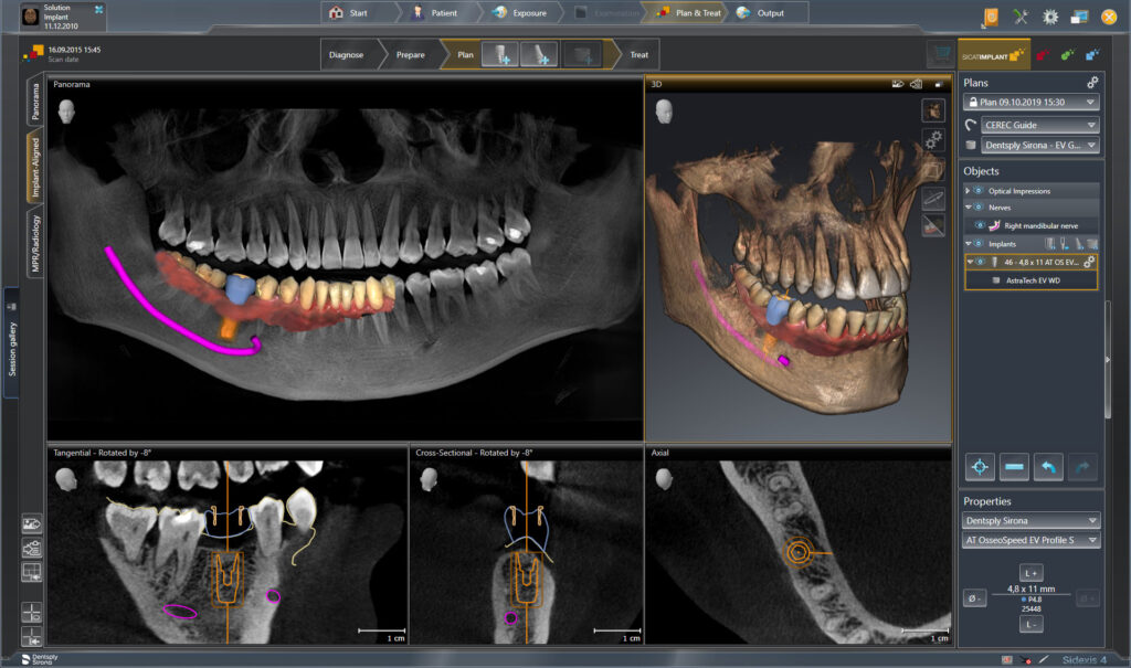 service informatique cime dentaire sicat implant dentsply sirona